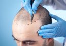 Restore Your Hair